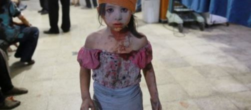 Vittime innocenti dell'assurda guerra Siriana