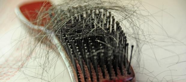 La pérdida de cabello puede deberse a múltiples factores La pérdida de cabello puede deberse a múltiples factores