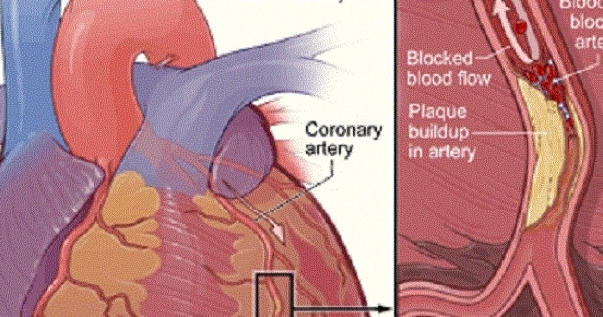 Sex Is Bad For Older Men But Good For 50 Women Msu Links Sex Heart