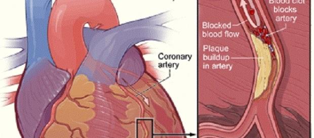 Sex Is Bad For Older Men But Good For 50 Women Msu Links Sex Heart