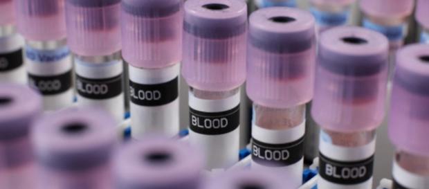 Un test sul sangue per scoprire se si ha il cancro Un test sul sangue per scoprire se si ha il cancro