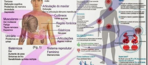Fibromialgia: a dor invisível que tanto debilita Fibromialgia: a dor invisível que tanto debilita
