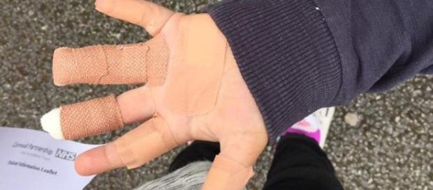 Cornovaglia, scoiattoli grandi aggrediscono bimbo in un parco Cornovaglia, scoiattoli grandi aggrediscono bimbo in un parco