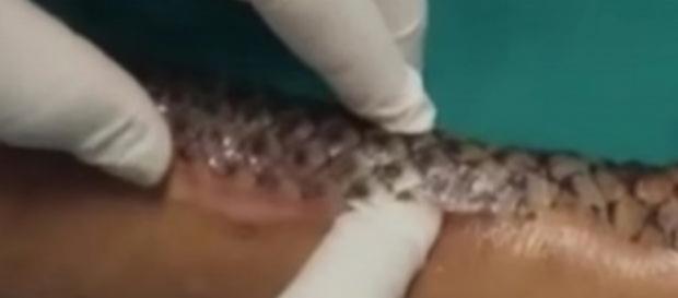 Depois de passar por um grande trauma e ter boa parte do seu corpo queimada, a garçonete mal podia acreditar em sua recuperação Depois de passar por um grande trauma e ter boa parte do seu corpo queimada, a garçonete mal podia acreditar em sua recuperação