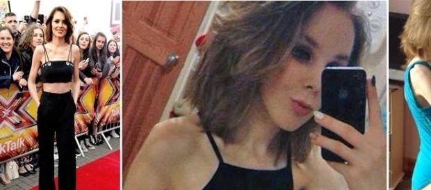 Na primeira imagem a adolescente em 2013 na fase avançada da doença, na segunda em 2016, já recuperada da anorexia. Na primeira imagem a adolescente em 2013 na fase avançada da doença, na segunda em 2016, já recuperada da anorexia.