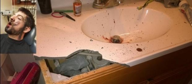 Homem perde 7 dentes após explosão de cigarro eletrônico Homem perde 7 dentes após explosão de cigarro eletrônico