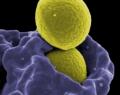 Superbug kills U.S. woman - 26 antibiotics failed to help