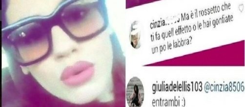 Giulia De Lellis si è gonfiate le labbra.