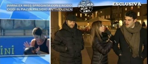 Ragazza sfregiata con l'acido a Rimini, migliorano le condizioni di Gessica Notaro