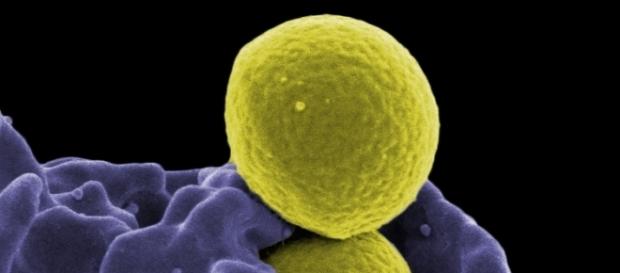 MRSA bacteria courtesy NIAID, flickr.com, government image CC0 MRSA bacteria courtesy NIAID, flickr.com, government image CC0
