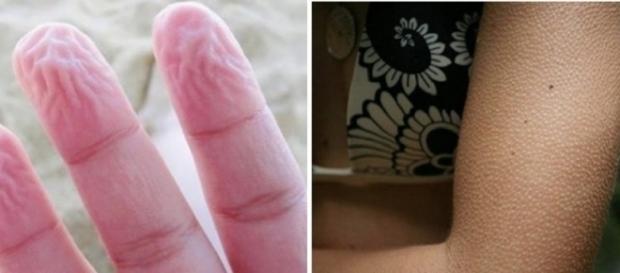 Quando nos arrepiamos, bocejamos, ou espirramos, na verdade, estamos sendo protegidos Quando nos arrepiamos, bocejamos, ou espirramos, na verdade, estamos sendo protegidos
