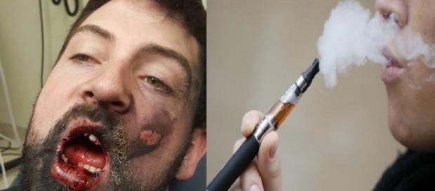Rosto de homem ficou muito diferente Rosto de homem ficou muito diferente