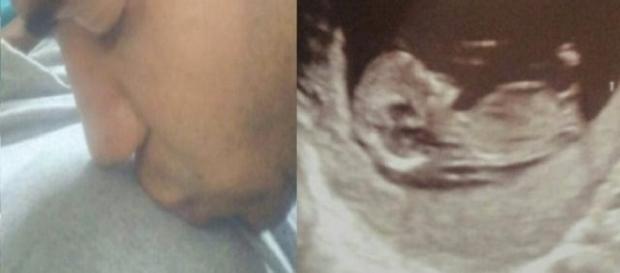 Viuva de Thiaguinho decide falar sobre o bebê que espera Viuva de Thiaguinho decide falar sobre o bebê que espera