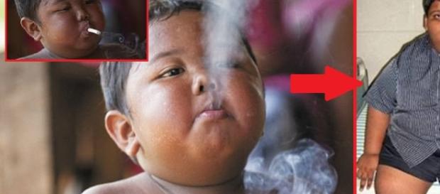 Menino que fumava 40 cigarros por dia Menino que fumava 40 cigarros por dia