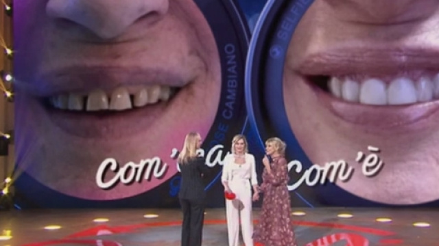 Selfie | Gemma Galgani si &egrave; rifatta i denti