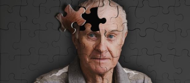 Un million d'Alzheimer en France aujourd'hui, deux millions dans 20 ans. Un million d'Alzheimer en France aujourd'hui, deux millions dans 20 ans.