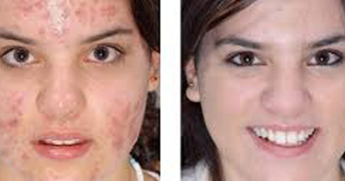 A Verdade Sobre O Que O Sabonete Faz Com A Saude E A Beleza De Sua Pele