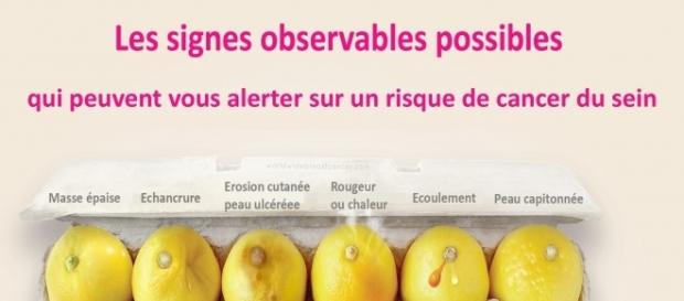 Repérer les signes du cancer du sein grâce aux citrons ... - sciencesetavenir.fr Traduite Repérer les signes du cancer du sein grâce aux citrons ... - sciencesetavenir.fr Traduite