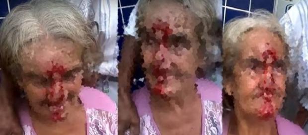 Senhora ficou com rosto sangrando após agressão Senhora ficou com rosto sangrando após agressão
