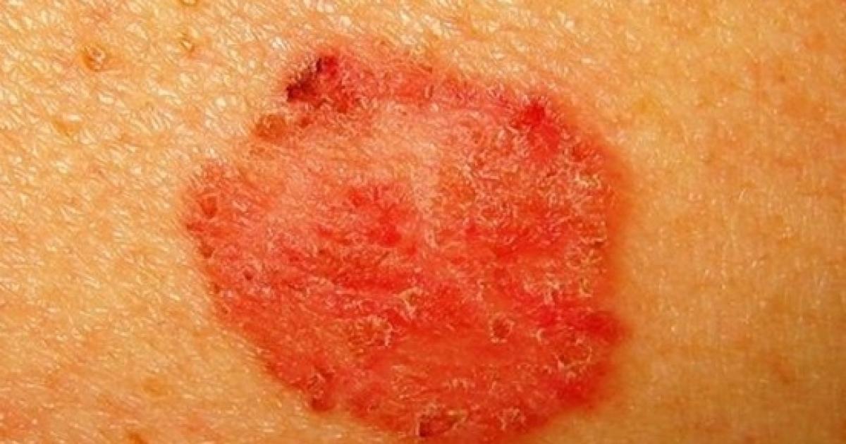 Confira 8 sinais que nosso corpo dá e que devemos prestar muita atenção