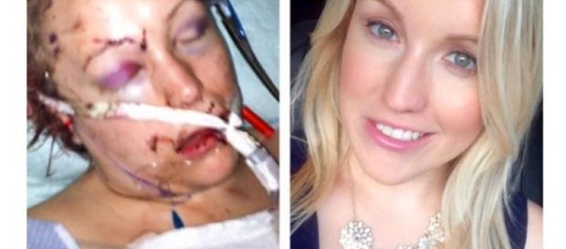Melissa Dohme após o ataque sofrido pelo seu ex. Melissa Dohme após o ataque sofrido pelo seu ex.