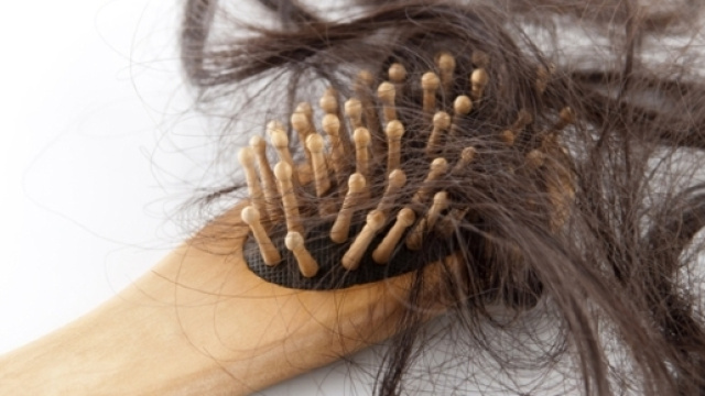 Sa'ravissante Beaut&eacute;: La chute de cheveux : Mes solutions pour en ... - blogspot.com