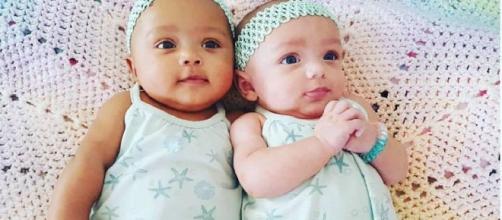 These twin baby girls have different skin colors - Photo: Blasting News Library - gazette.com