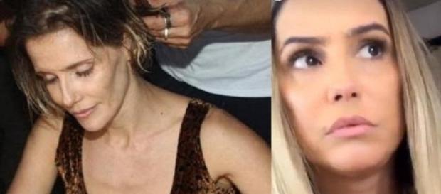 Débora Secco relata motivo de inchaço no rosto Débora Secco relata motivo de inchaço no rosto