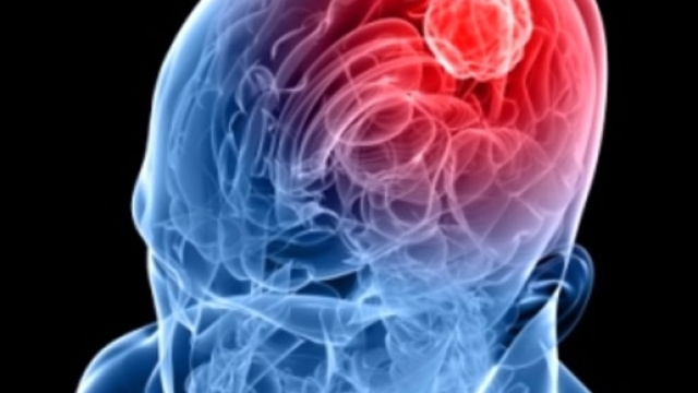 Caso meningite, nessuna epidemia