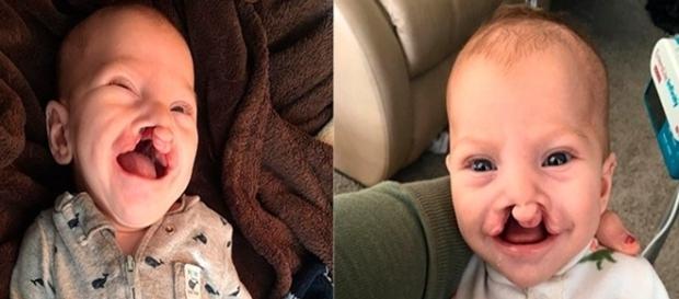 Brody é um bebê lindo e feliz, mas vivia sendo xingado na Web. Brody é um bebê lindo e feliz, mas vivia sendo xingado na Web.