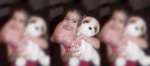 Melyssa em foto antes da cirurgia que salvou sua vida Melyssa em foto antes da cirurgia que salvou sua vida