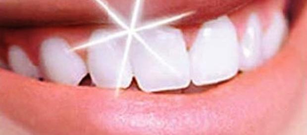 Sorriso do paciente após clareamento dental caseiro. (https://goo.gl/images/9a3FnW) Sorriso do paciente após clareamento dental caseiro. (https://goo.gl/images/9a3FnW)