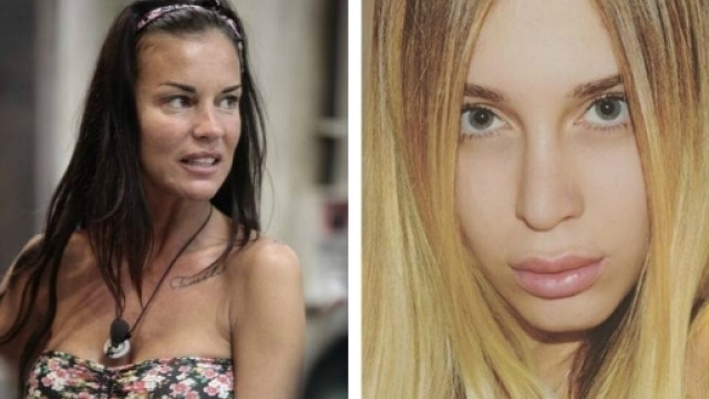 Antonella Mosetti ricoverata in ospedale: l'intervento.