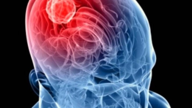 Meningite, stavolta c'&egrave; lieto fine: sta meglio il bimbo di 4 anni ... - intelligonews.it