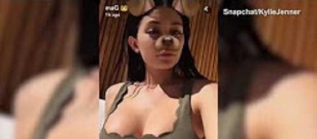 Source: Youtube user 2017. Kylie Jenner flaunts plastic surgery in bikini Source: Youtube user 2017. Kylie Jenner flaunts plastic surgery in bikini