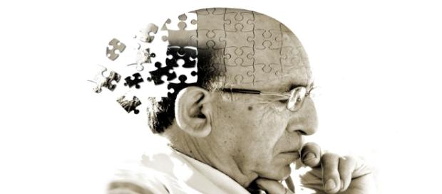 Nuova frontiera per la cura dell'Alzheimer Nuova frontiera per la cura dell'Alzheimer