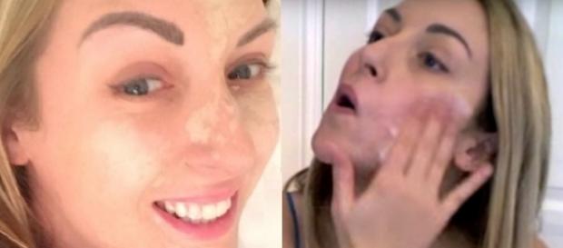 Blogueira e youtuber usa esperma no rosto contra rosácea e ainda eternizou seus lábios vaginais Blogueira e youtuber usa esperma no rosto contra rosácea e ainda eternizou seus lábios vaginais