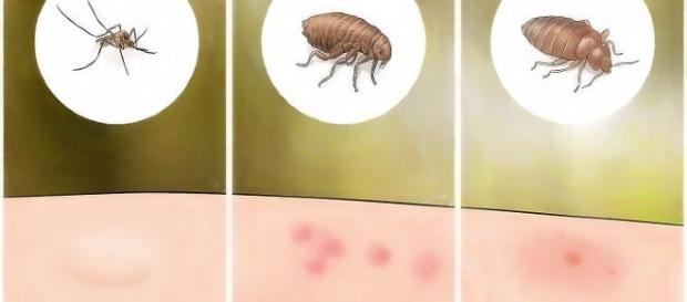 Cada inseto provoca uma reação diferente no corpo Cada inseto provoca uma reação diferente no corpo