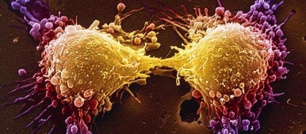 Nova terapia tem o mesmo funcionamento da fosfoetanolamina sintética Nova terapia tem o mesmo funcionamento da fosfoetanolamina sintética
