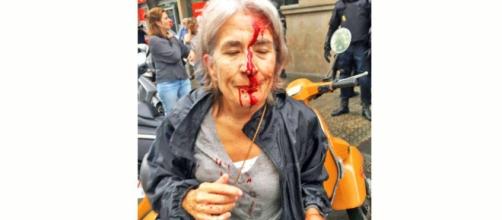 Mujer herida por las fuerzas policiales de Rajoy