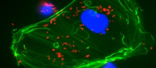 Scientists have studied techniques to assess the foodborne infection listeriosis (Image Institut Pasteur/Twitter). Scientists have studied techniques to assess the foodborne infection listeriosis (Image Institut Pasteur/Twitter).