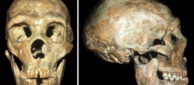 Il cranio di Shanidar, che presenta lesioni incompatibili con la vita di allora Il cranio di Shanidar, che presenta lesioni incompatibili con la vita di allora