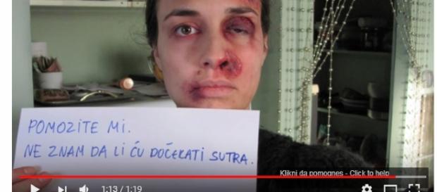 Mulher, durante um ano, fotografou-se mostrando sua realidade (Foto: Captura de vídeo) Mulher, durante um ano, fotografou-se mostrando sua realidade (Foto: Captura de vídeo)