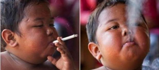 Lembra do menino que fumava 40 cigarros por dia? Lembra do menino que fumava 40 cigarros por dia?