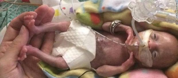 O bebê de Courtney Stensrud é considerado o bebê mais prematuro a sobreviver na história da medicina O bebê de Courtney Stensrud é considerado o bebê mais prematuro a sobreviver na história da medicina