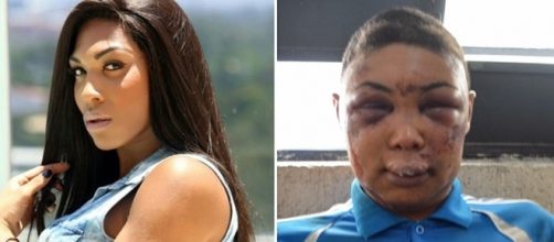 Verônica Bolina antes e depois das agressões, em 2015.