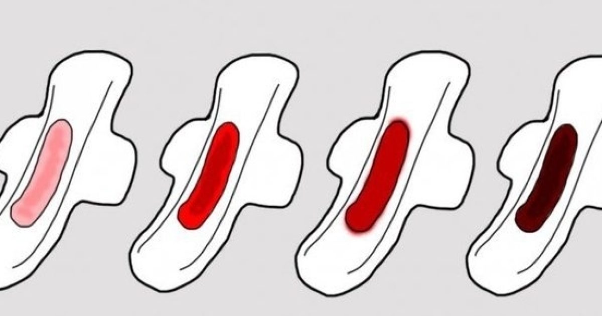SOS Dr - As alterações na cor do sangue da menstruação são normais, pois  representam cada fase do ciclo. Porém, caso você apresente sangue menstrual  aguado acinzentado, rosado ou alaranjado, é importante