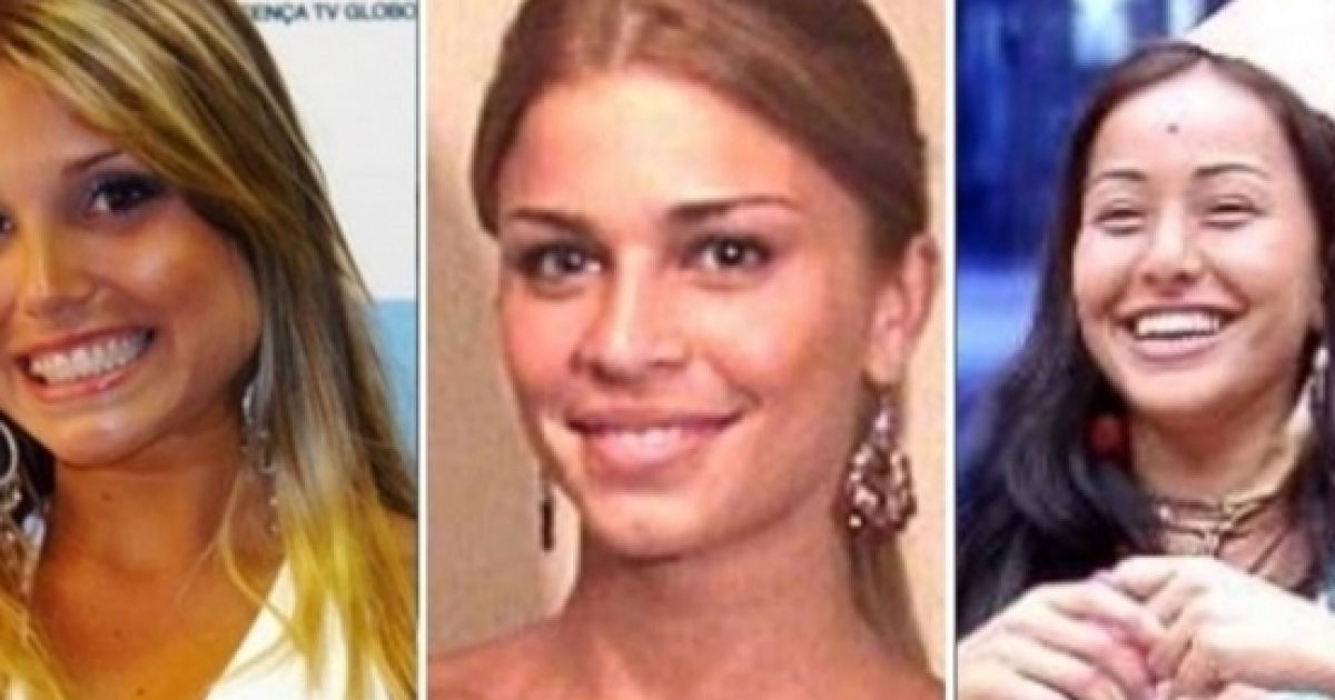 Veja E Compare O Antes E Depois De Ex-participantes Do Big Brother Brasil