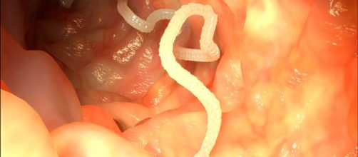 Vermi parassiti potrebbero prevenire il morbo di Crohn | Pazienti.it - pazienti.it