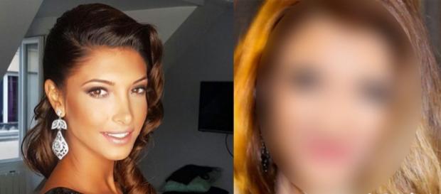 Mélanie Dédigama : Une nouvelle photo choc qui confirme les rumeurs de chirurgie esthétique ! Mélanie Dédigama : Une nouvelle photo choc qui confirme les rumeurs de chirurgie esthétique !
